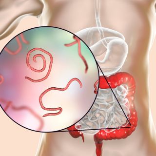 Eliminación Efectiva de Parásitos